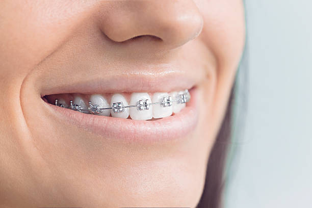 Dental Inlays and Onlays in Clinton, PA